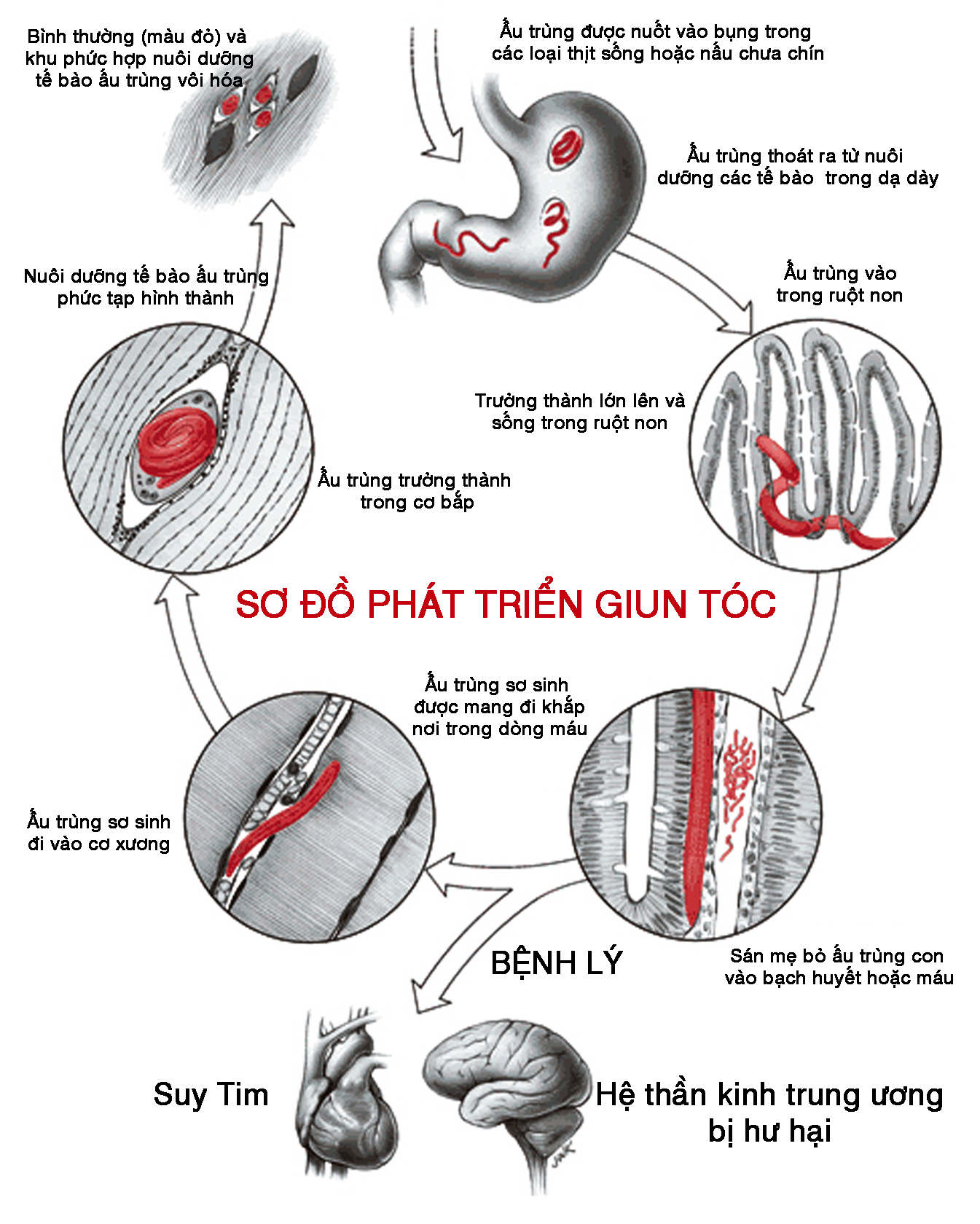 sÆ¡ Ä�á»� giun tÃ³c.jpg